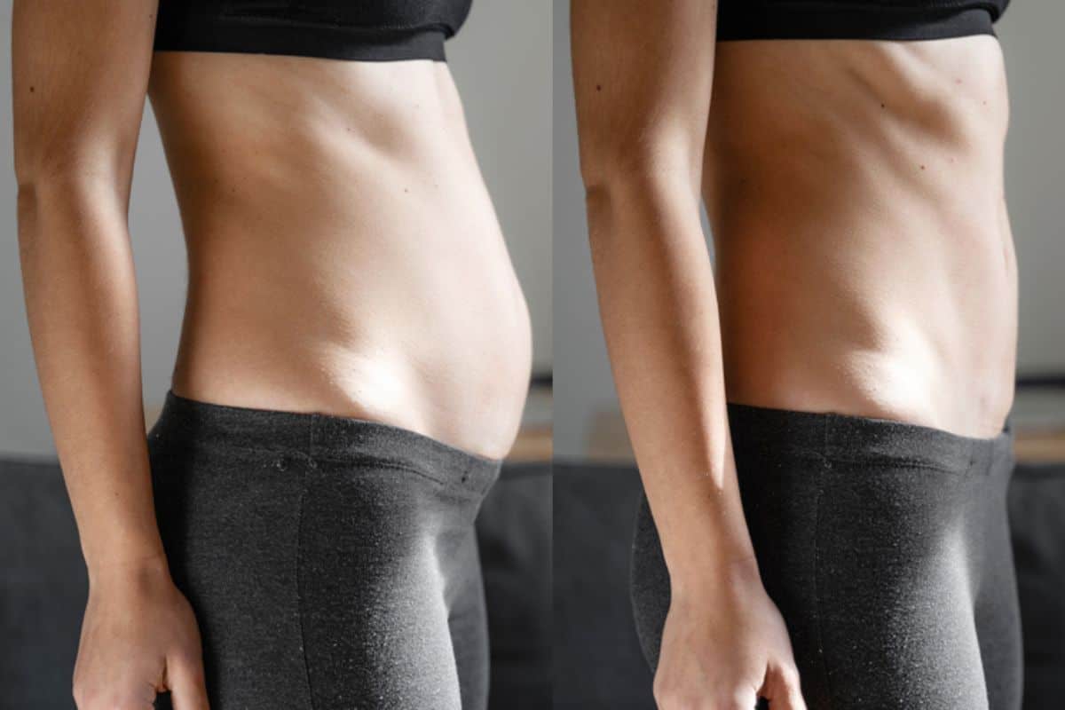 Post-Pregnancy: What Happens to Your Abdominal Muscles After Birth Romford