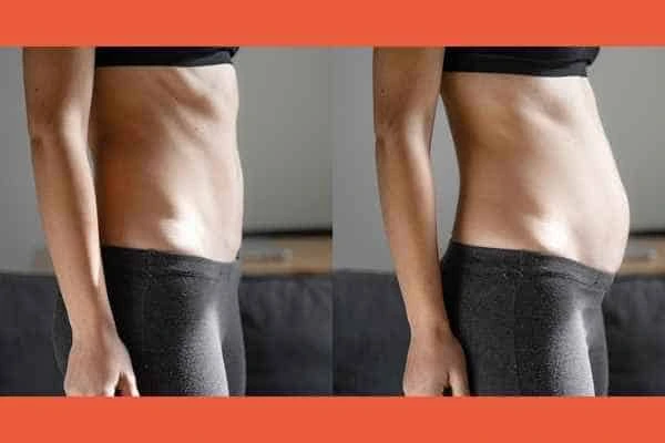 LA-EMS Body Sculpting results Romford