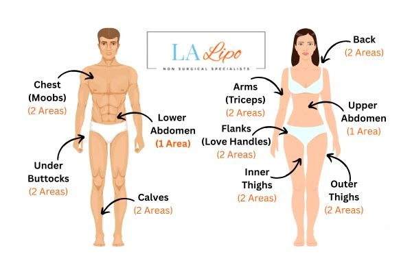 LA LIPO Cryolipolysis Areas Romford