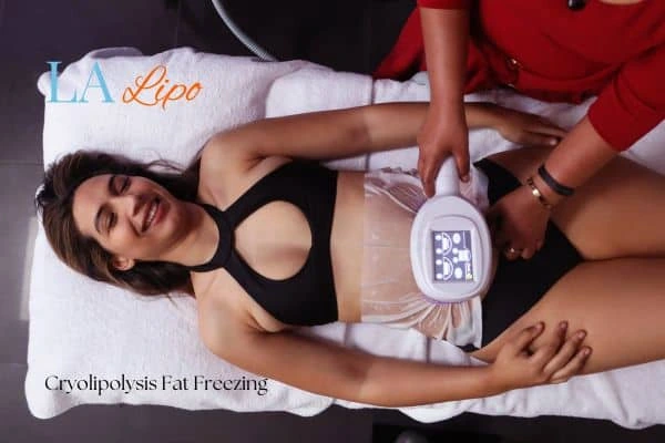 woman getting cryolipolysis Romford