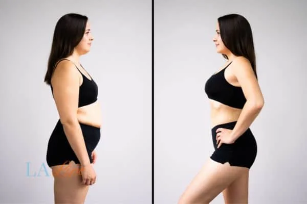 link between body image and mental health Romford