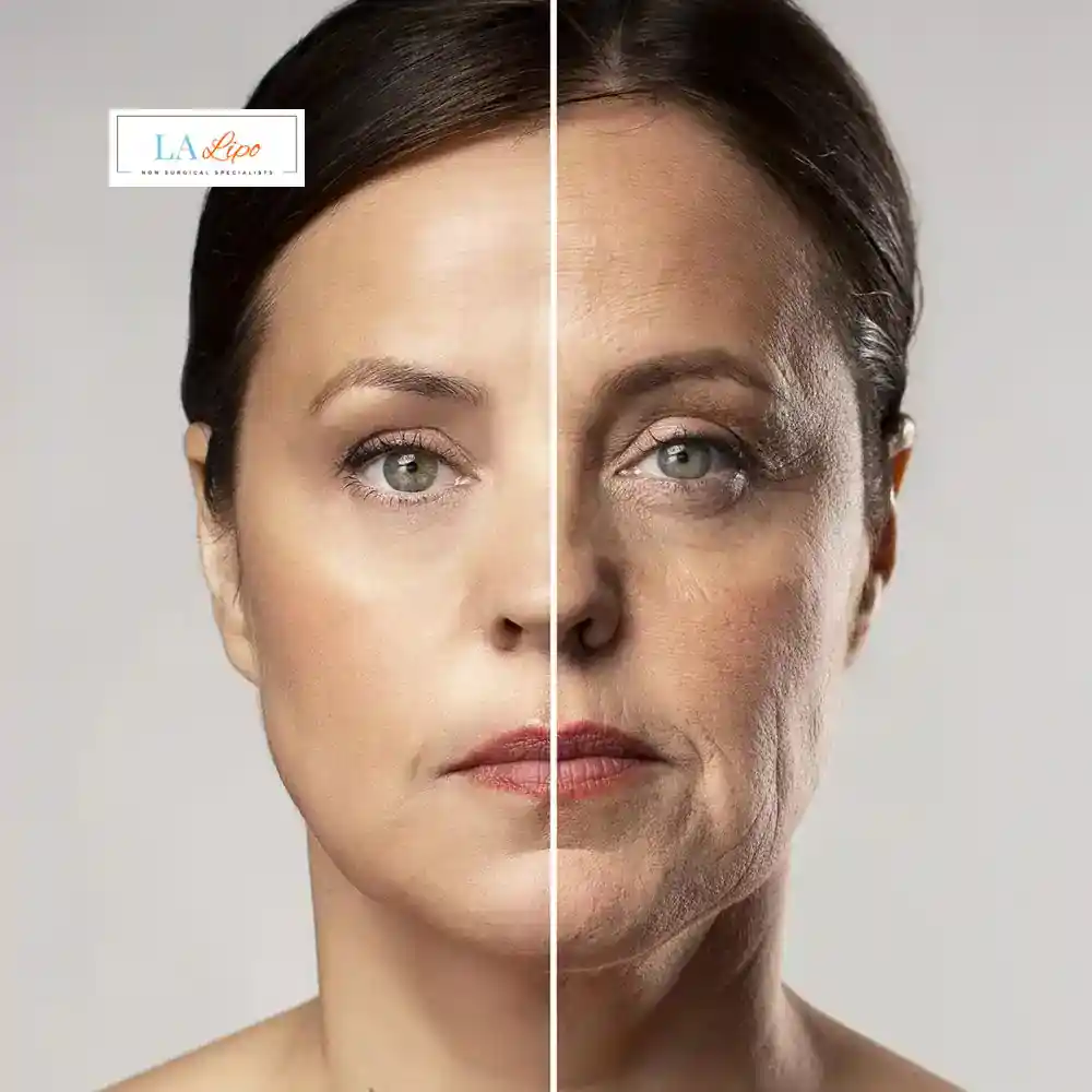 How Can You Tell If Non-Surgical Skin Tightening Is Right for You Romford?